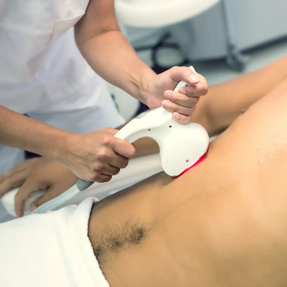 Fotografía de chico en una sesión de depilación láser de abdomen.